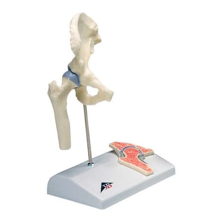 Fabrication Enterprises 3B Anatomical Model - Mini Hip Joint with Cross Section of Bone on Base 956176